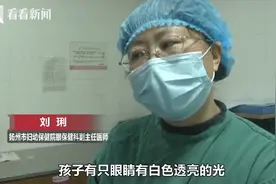 8个月宝宝眼睛会“发光”医生一查发现情况不妙图片