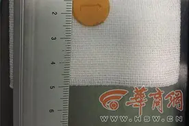 山西2岁女孩误吞塑料薄片长时间未发现 远赴西安急求医图片