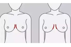 女生什么样的胸型好看？切记盲目追求丰胸方法图片