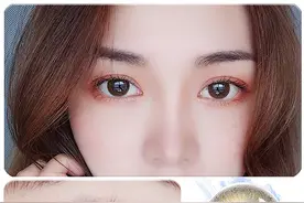 问壹点｜吓得我赶紧摘下了它！是美瞳还是“毁瞳”眼科医生这样说图片