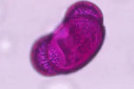 北京松科花粉始期预报图片