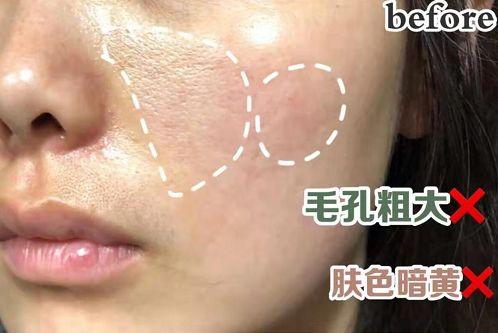 鱼胶原蛋白肽粉的可以长期使用吗 鱼胶原蛋白肽粉固体饮料长期喝有没