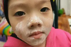 3岁女儿总爱抓破脸涂药膏无果 杨威无奈发文求助图片