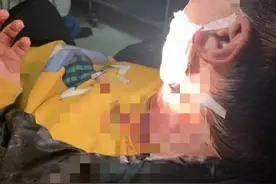 事发大连！男子小区里遛狗，被陌生男子刀捅颈部图片