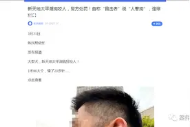 在新天地被狗咬的他，脸上缝了20多针，后续来了图片