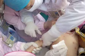 富源：医生教你如何预防 辨别 治疗，宝宝感染“水瘊子”图片
