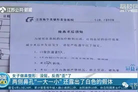 瑟瑟发抖！女子整容后鼻头斜了，修复一下结果鼻孔又歪了图片