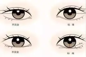 开眼角不仅可以让眼睛变大，还有这几个好处你没想到图片