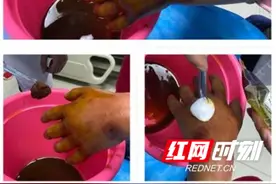 小心了！“多脚虫”差点毁了她的一只手图片