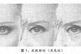 岁月可流逝，美人不迟暮——中医教你抹去皱纹图片