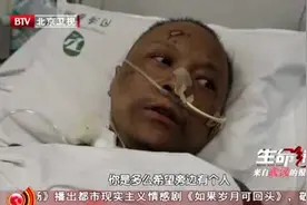 武汉两医生得新冠被救回后容貌变了，脸部发黑！专家这样解释→图片