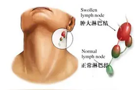 切肤之痛！摸到皮下长了东西如何处理？图片