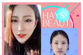 动一下鼻基底，全脸就能变好看？图片