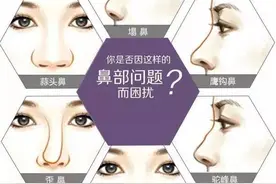 「隆鼻指南」单纯隆鼻与鼻综合有啥不一样？图片