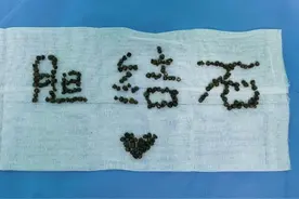 慎点！60岁阿姨的胆囊里取出来198颗结石，护士还用这些石头摆出一个造型图片