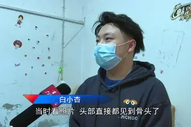 三月龄女婴在家被不明动物啃食？具体原因仍在调查图片