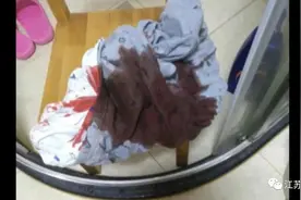“血都是飙出来的！”8岁男童半夜血染床单图片
