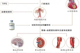肝肾综合征的发病机制及治疗策略图片