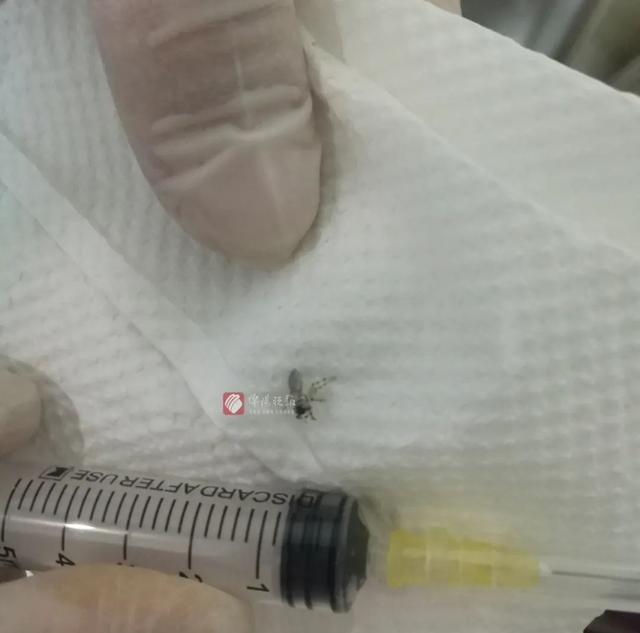 蜘蛛进耳朵里怎么办