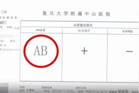 惊讶！母亲打算割肝救子，一查养了28年的儿子非亲生图片
