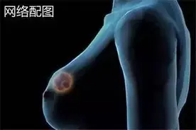 乳腺科普｜为什么乳腺疾病的女性越来越多？图片