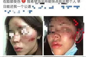 成都女子深夜回家路遇三男子，被调戏还遭殴打！警方介入调查图片