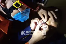 惊险！杭州男子被鱼钩钩穿眼皮，钱塘江边曾有小姑娘被钩伤眼睛图片