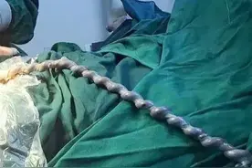 孕妇无症状，胎儿险窒息，桂林妇幼远程胎监为生命争取“黄金”时间图片