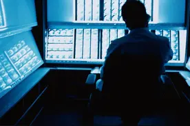 选择实体胶片还是云胶片？我们请医生算了一笔账，结果一目了然……图片