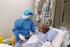 东莞最后一名新冠肺炎危重型患者脱机成功 面部和胳膊皮肤已变黑图片