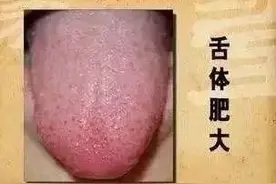 原来祛湿气最厉害的，不是薏米，而是它！图片