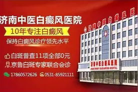 为什么白癜风发展至面部的概率比其他部位大？图片