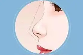 韩啸乃巧鼻解析—错误的审美造成肉眼可见的“假”图片