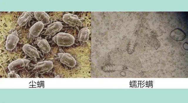 天然有机氨基酸洁面原液告诉你，脸上的“螨虫”怎么去除，让你素颜好看100倍