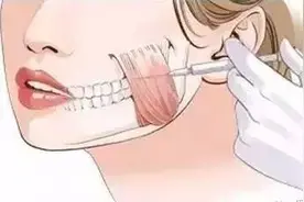 打瘦脸针，不是你说了算！她想打也打不了？图片