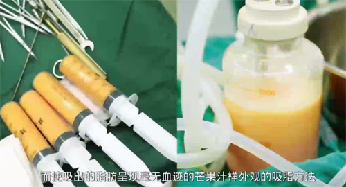 移植后吃了花胶 2026年移植后吃了花胶会怎么样