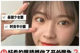 想要日系无辜大眼惨遭医生拒绝？为啥外眼角不能随便开图片