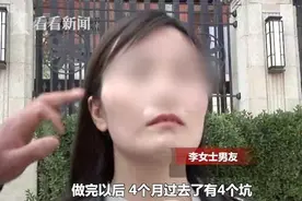 脸太瘦不够“旺夫”？女子花4万整容 结果成了这样图片