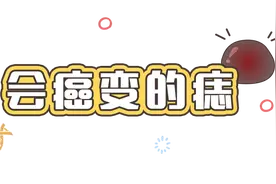 痣也可能会癌变！长在3个地方要注意图片