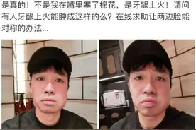 俞灏明“脸肿如瓜”网友留言：神似刘翔和潘粤明图片