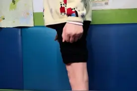 【科普工作委员会】 脑瘫儿童膝过伸运动治疗图片