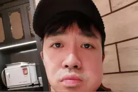 俞灏明牙龈上火脸肿超大，网友在线支招：问问周冬雨图片