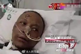 欣慰｜易凡医生出院！曾因“面容变黑”备受关注图片