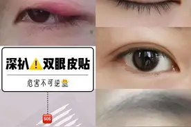 双眼皮贴真能贴成双眼皮？信了这个邪你就算是栽了图片