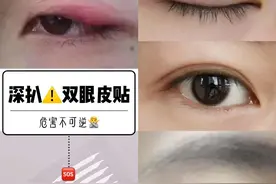 双眼皮贴真能贴成双眼皮？信了这个邪你就算是栽了图片