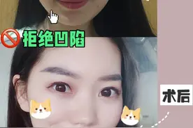 为什么有的人做面部填充美爆了，有的人却变“假脸”?图片
