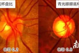 @600°+高度近视人群，每年拍这样一张照片很重要图片