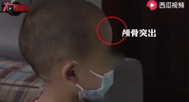 有孩子两年喝89罐，揭郴州大头娃娃奶粉真面目：利润是奶粉两倍多，公司用“种太阳”作为品牌销售