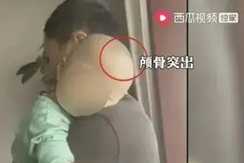 “郴州大头娃娃”涉事蛋白粉公司回应称产品合格，家长发声图片