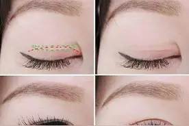 你要知道的双眼皮贴三宗罪：别美了一时，毁了一世图片